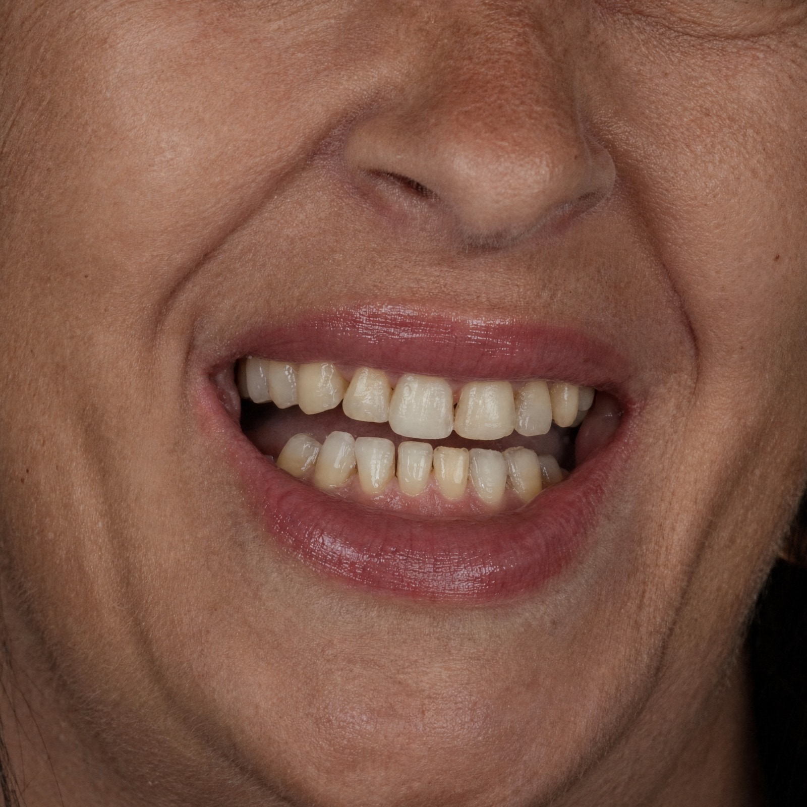 Una sonrisa que ilumina · Antes del tratamiento