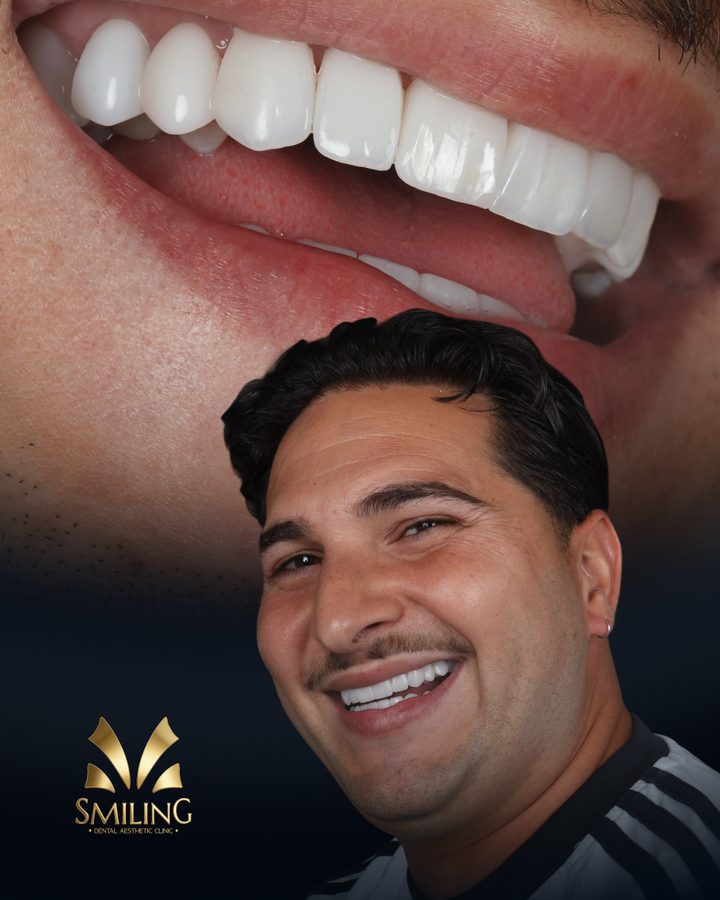 Paciente de Smiling con su nueva sonrisa