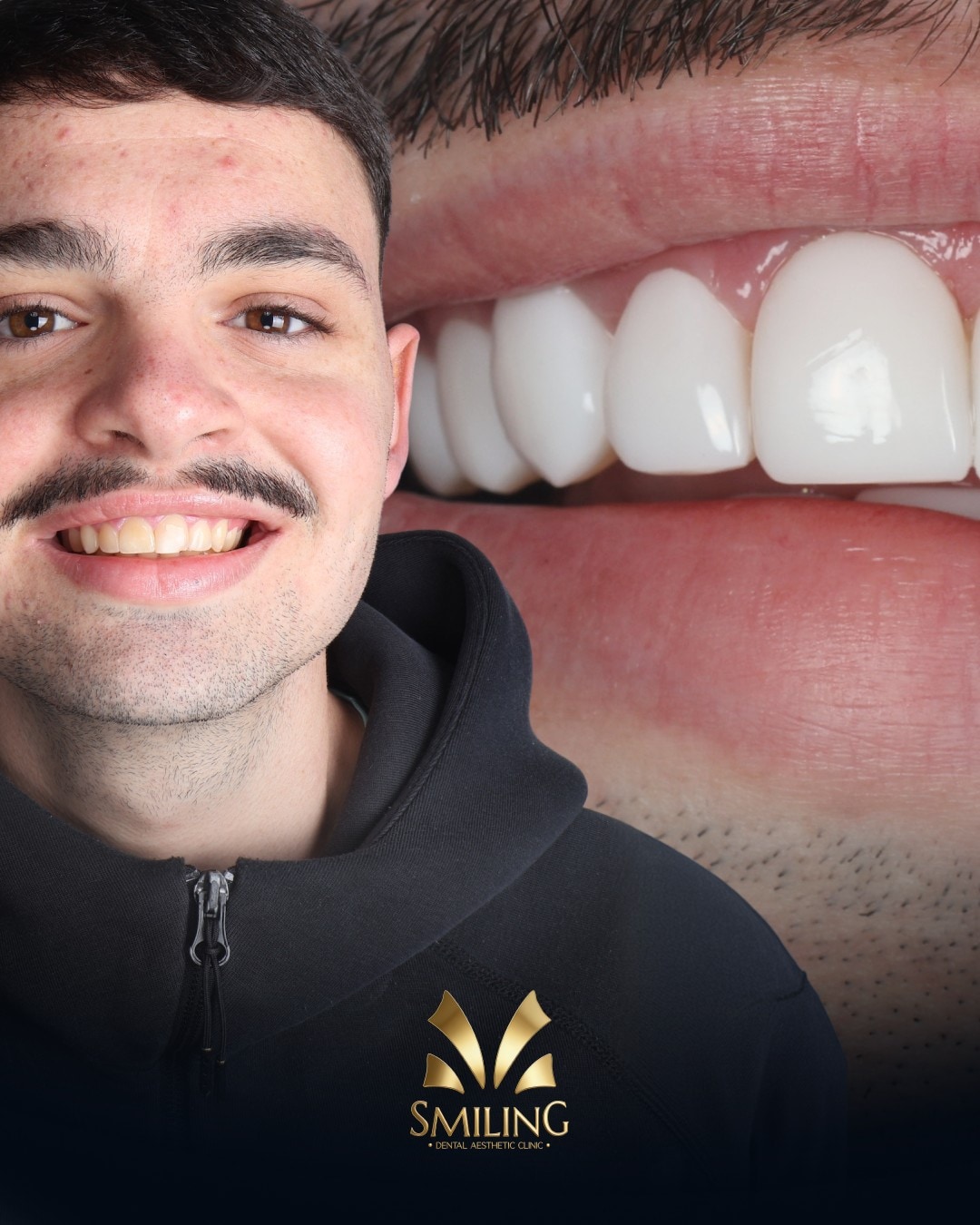 Paciente de Smiling con su nueva sonrisa