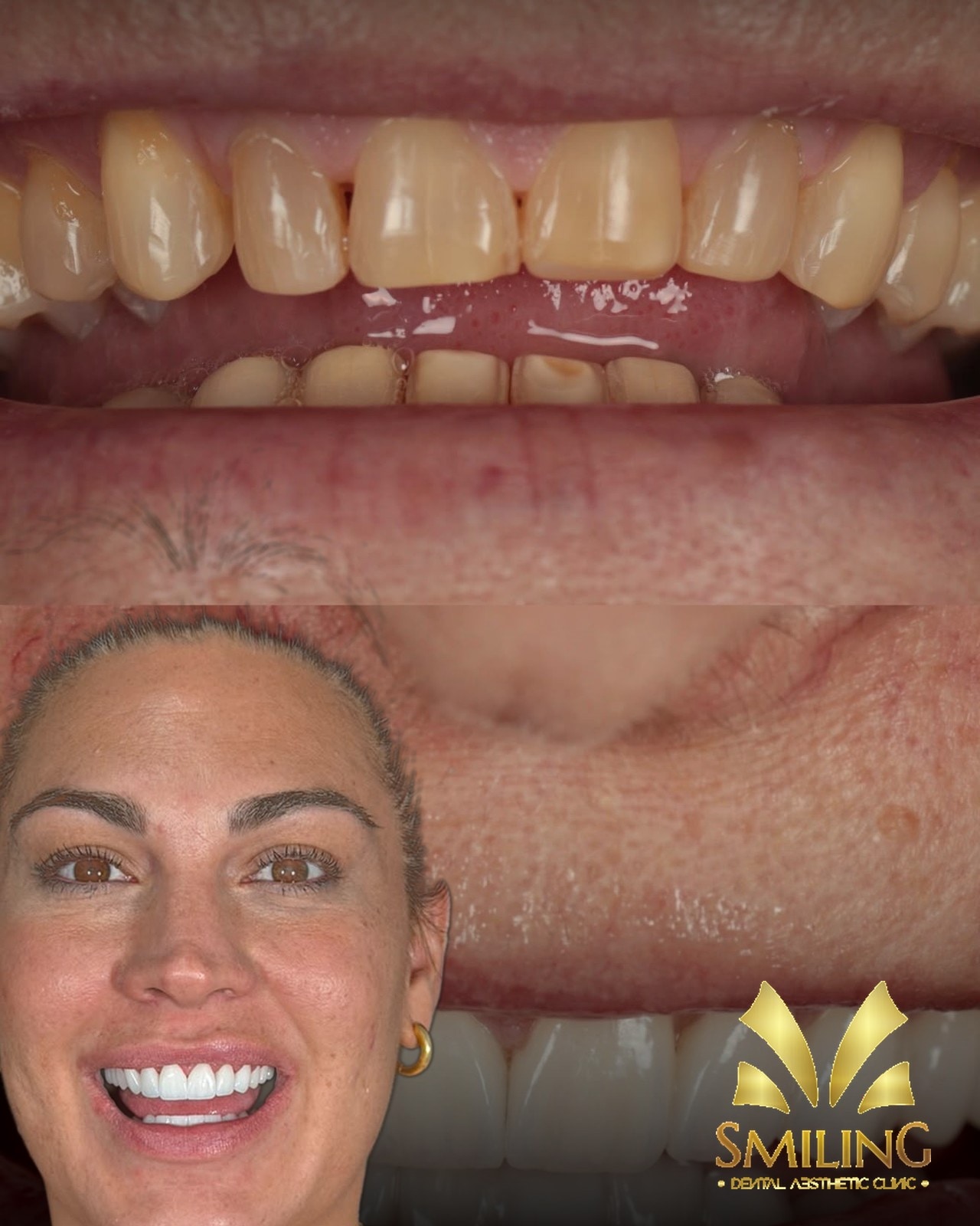 Paciente feliz con su nueva sonrisa sana